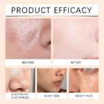 Papaya Face Wash Deep Exfoliating Oil Control Prevents Acne & Blackheads Brightening Pore Minimizing Cleanser For All Skin Types - Image 6
